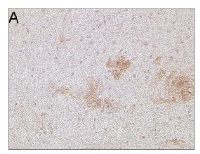 Amyloid beta oligomer-specific monoclonal antibody (OMAB) in the group Antibodies Human Cell Biology / Neuroscience / Neurodegenerative diseases / Alzheimer's disease at Agrisera AB (Antibodies for research) (AS10 932)